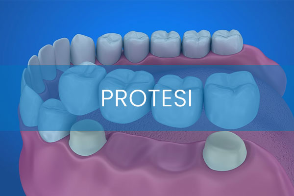 05_Protesi