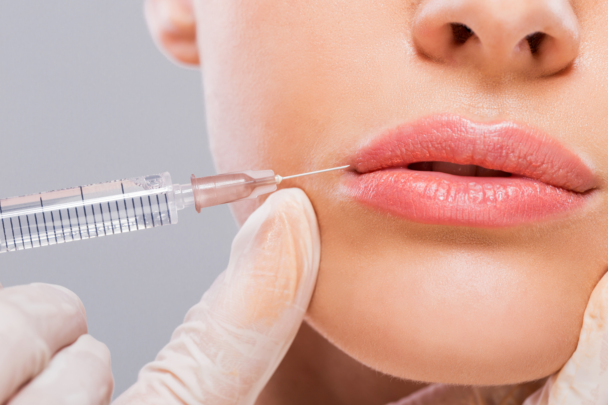 Filler viso e labbra