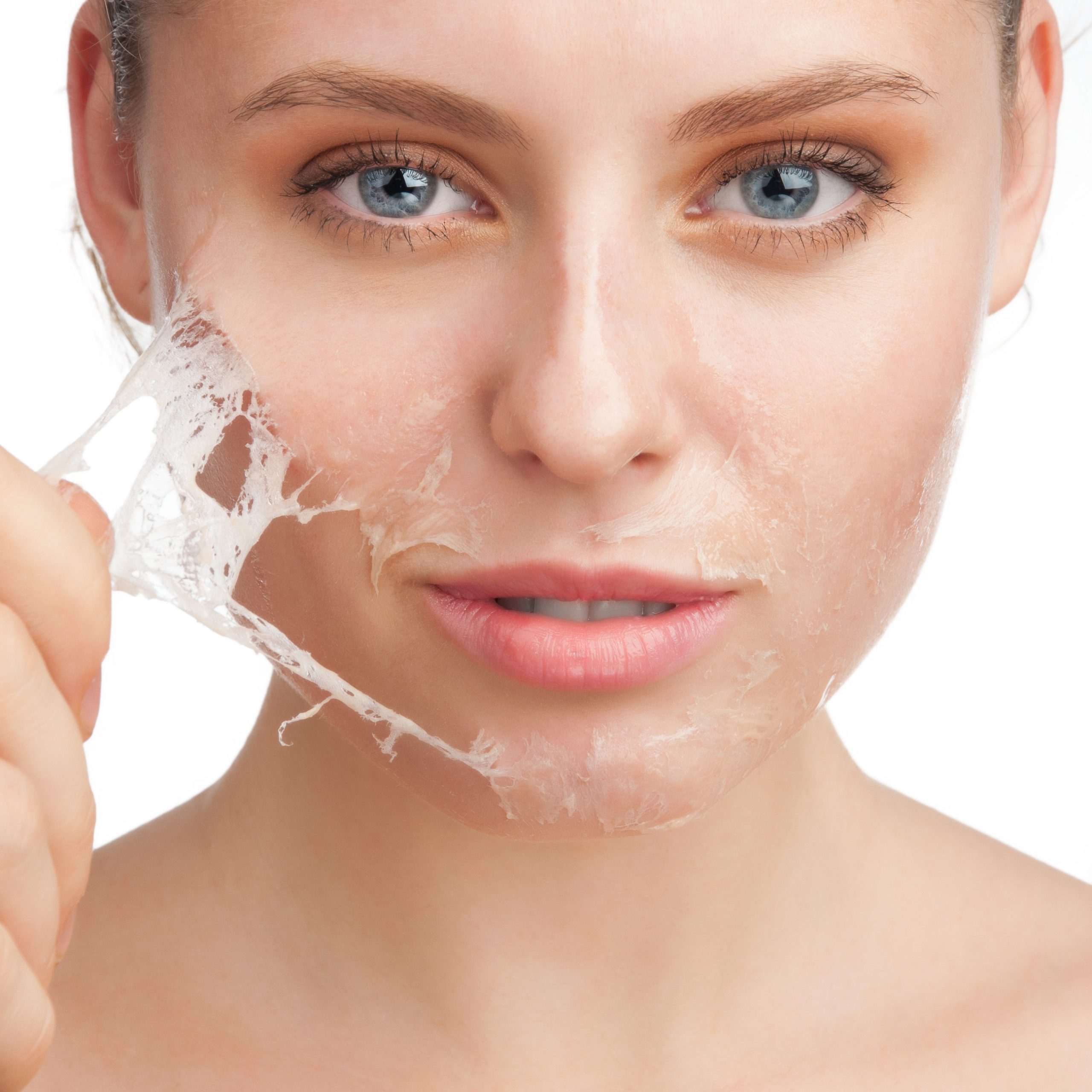 peeling chimico pelle