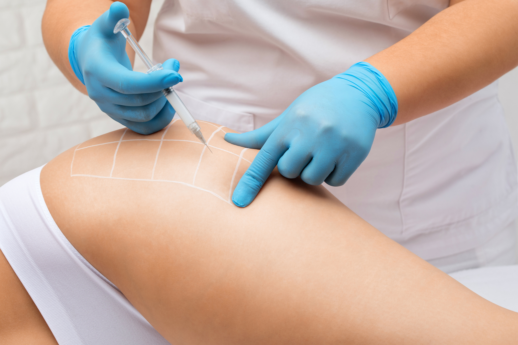 mesoterapia corpo