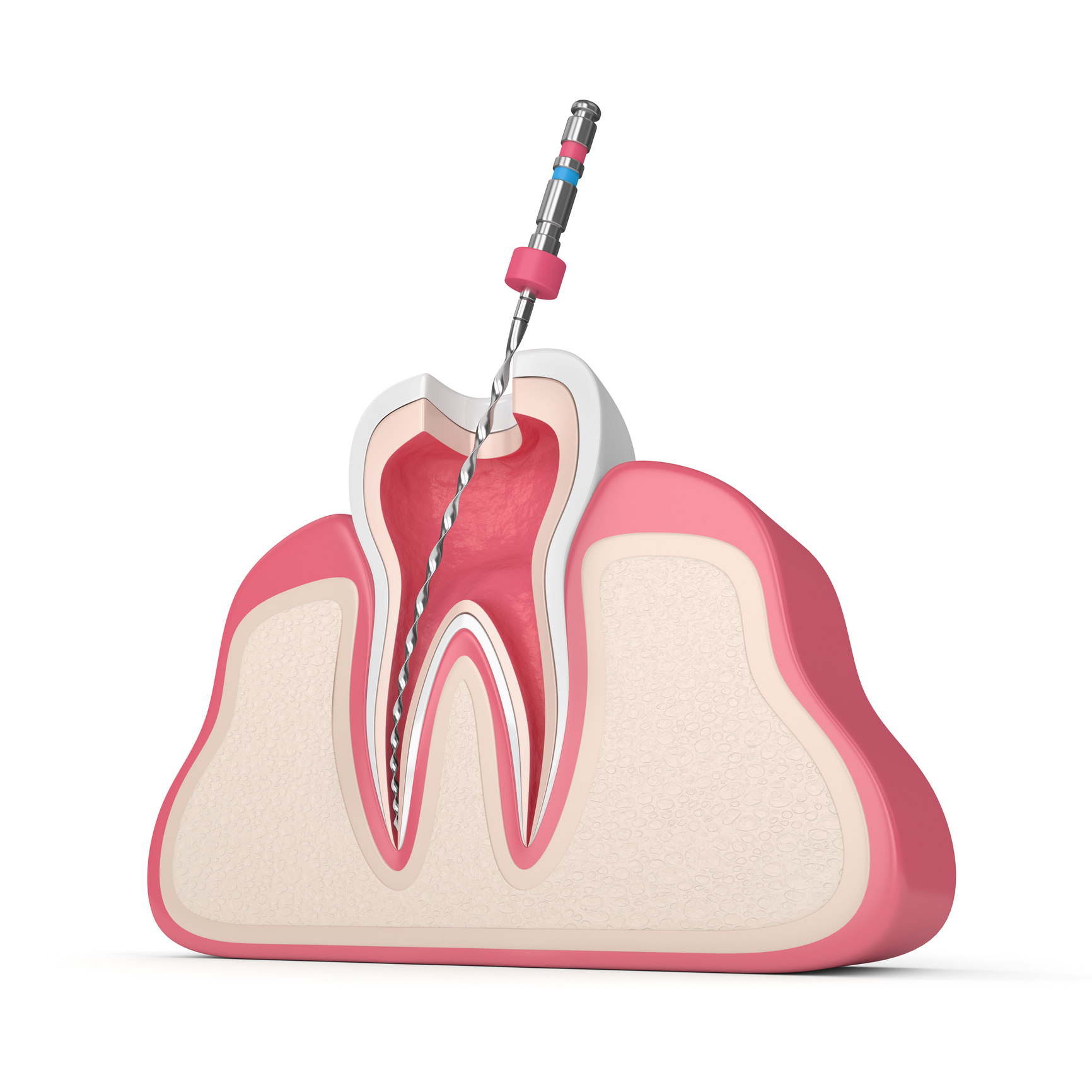 endodonzia endodonzia