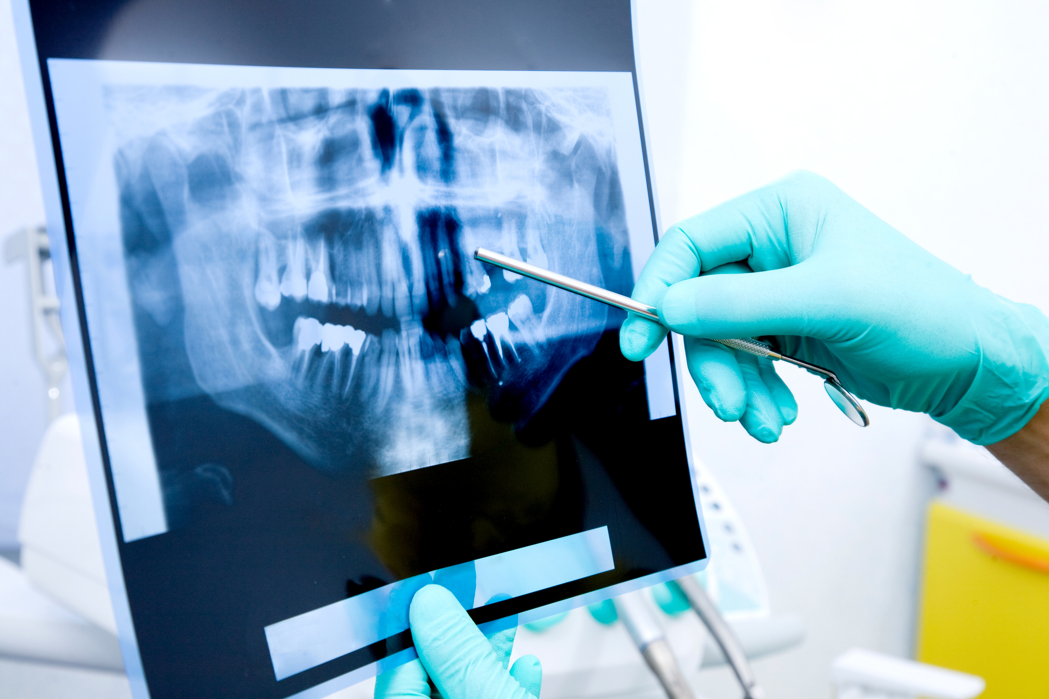 X-ray